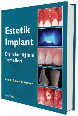 Estetik İmplant